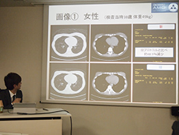 第１６回ＡＭＧ放射線部 ＣＴ技術研究会