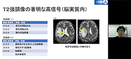 第20回AMG放射線部MRI技術研究会