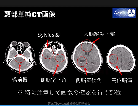 第36回AMG放射線部 合同研修会