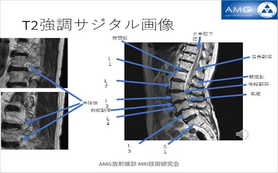 第25回AMG放射線部 MRI技術研究会