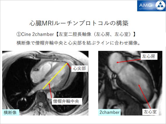 第26回AMG放射線部 MRI技術研究会