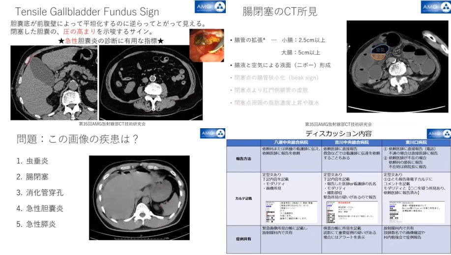 第35回AMG放射線部 CT技術研究会